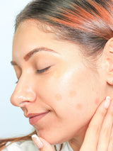 Skin tint hydrocolloid pimple patches - 14 Patches: MEDIUM My Spa Life